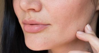 How to Tell Dry Skin From Dehydrated Skin?