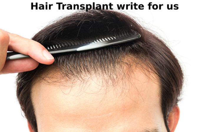 Hair Transplant write for us