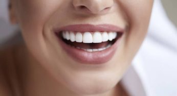 How Cosmetic Veneer Materials Differ